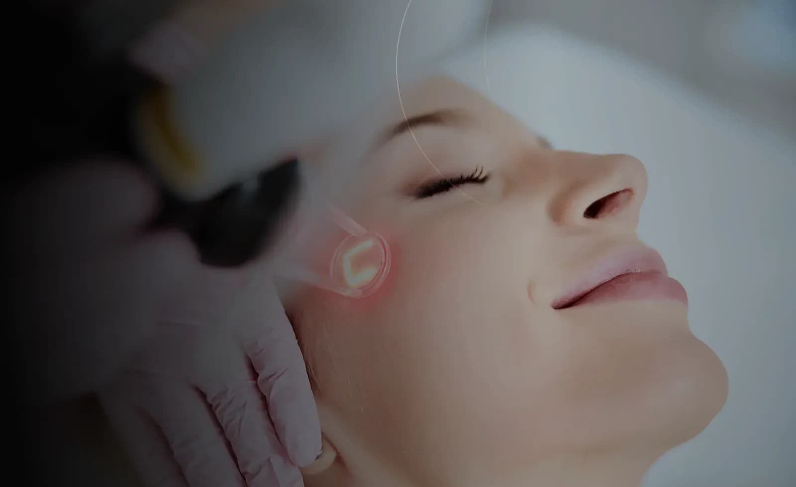 Acne Scar Treatment in Dubai at Endless Beauty Clinic Dubai
