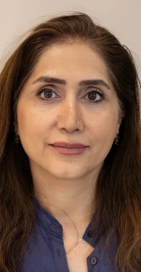 Hair Treatment Density Improvement before treatment