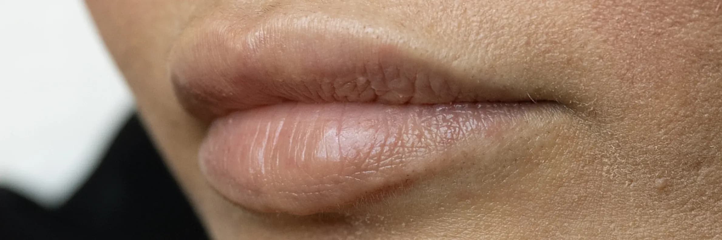 Permanent Lip Blush Result before treatment