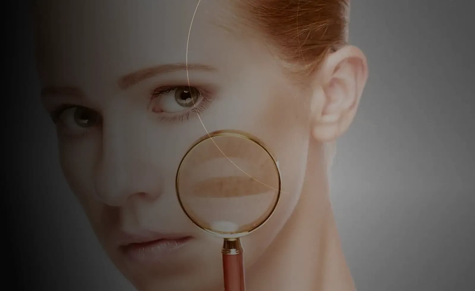 Pigmentation & Melasma Treatment in Dubai at Endless Beauty Clinic Dubai