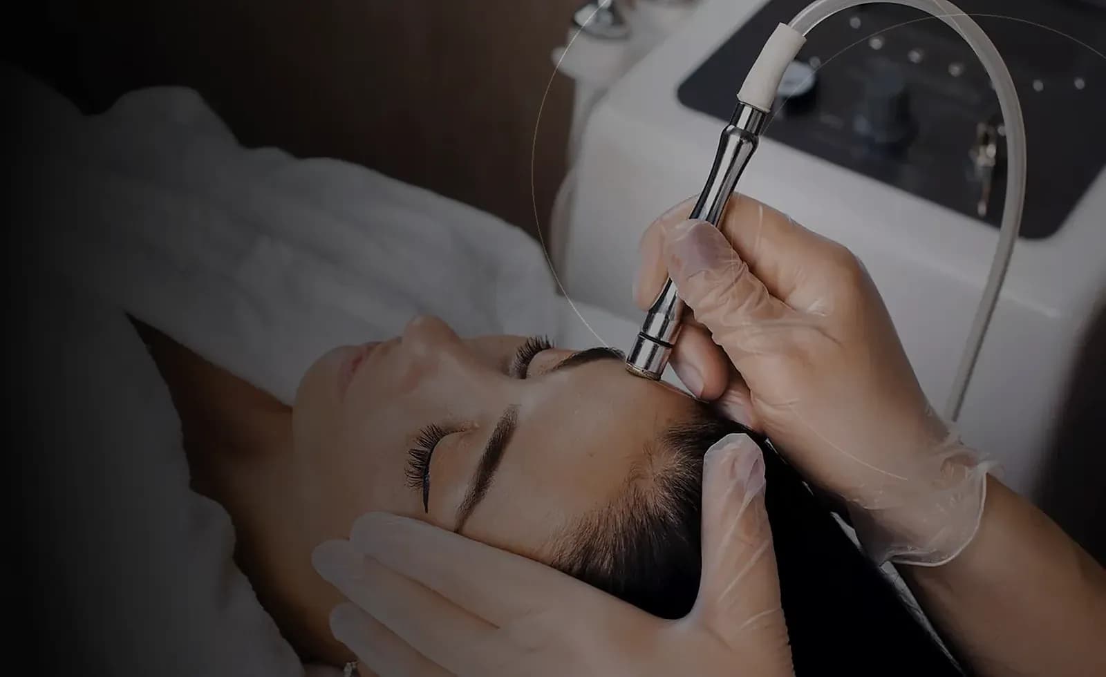 RF Microneedling in Dubai at Endless Beauty Clinic Dubai