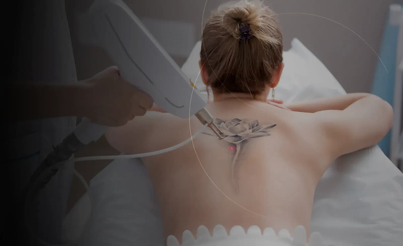 Laser Tattoo Removal in Dubai at Endless Beauty Clinic Dubai