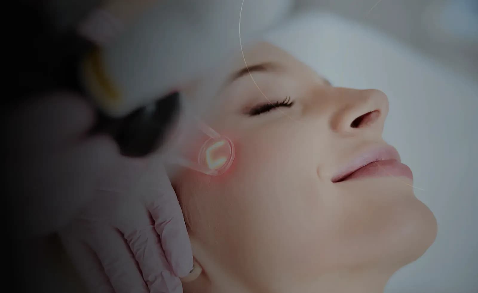 Stretch Mark Treatment in Dubai at Endless Beauty Clinic Dubai
